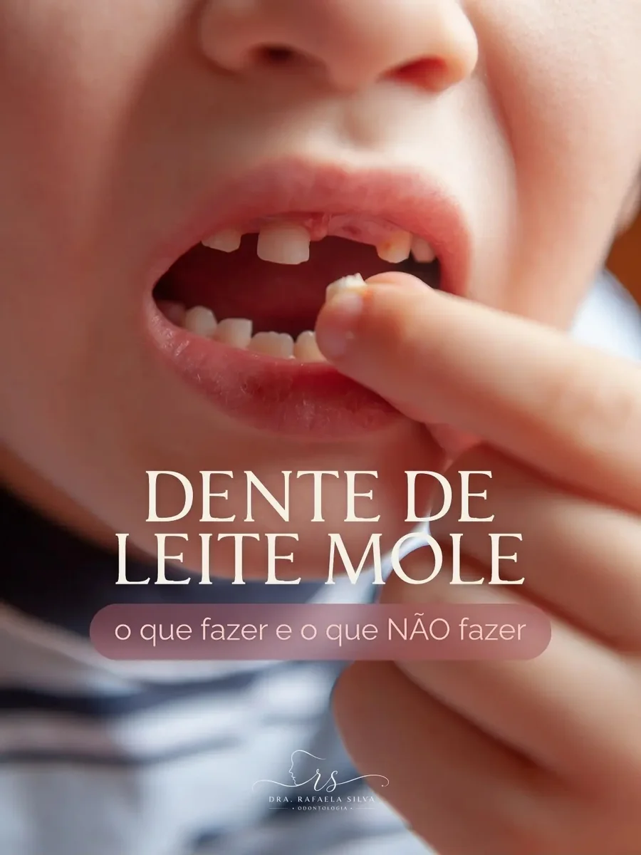 Post: dente de leite mole, o que fazer e o que não fazer